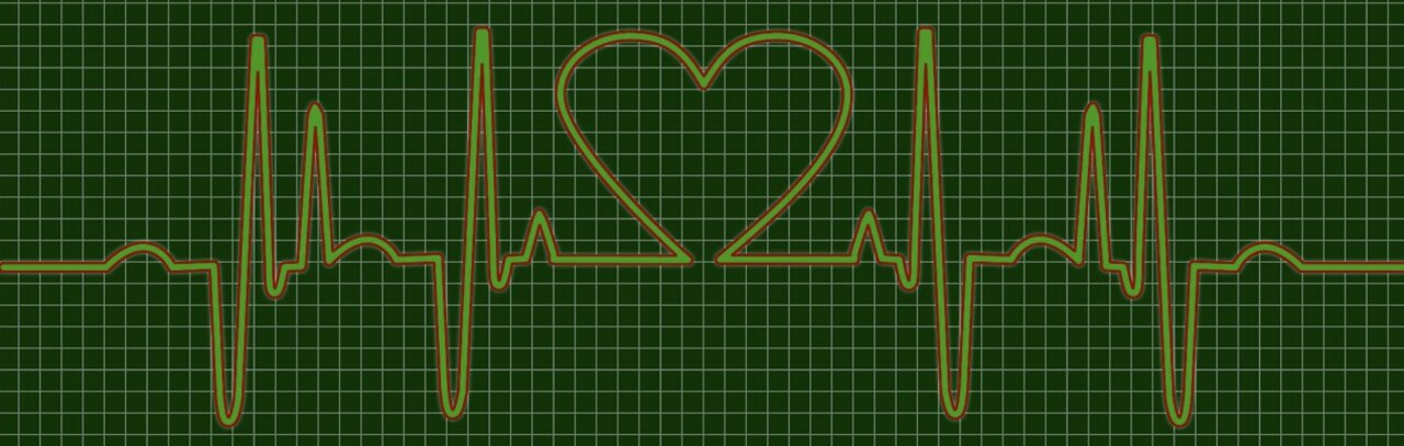 heartbeat graph