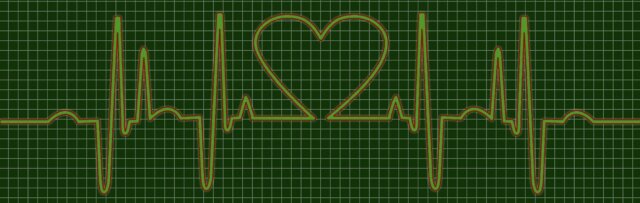 heartbeat graph